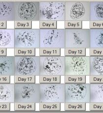 Сравнительный анализ микроскопов для определения овуляции по слюне. Возможность покупки прибора на iHerb.com
